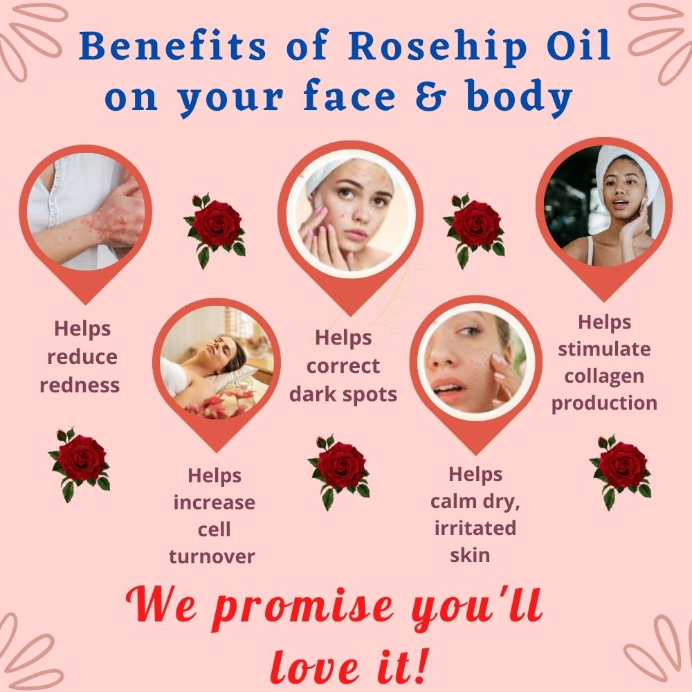 Virgin Rosehip Seed Oil 1oz - Made With Organic Rosehip Seed Oil - 100%  Pure Essential Oil Non-GMO Cold Pressed Rose Hips - Christina Moss Naturals